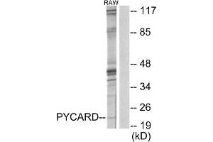 Western blot analysis of extracts from RAW264. (STS 抗体  (N-Term))