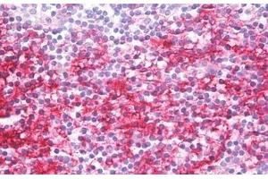 Human Tonsil: Formalin-Fixed, Paraffin-Embedded (FFPE) (CD40 抗体)