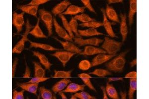 Immunofluorescence (IF) image for anti-NADH Dehydrogenase (Ubiquinone) 1 alpha Subcomplex, Assembly Factor 4 (NDUFAF4) antibody (ABIN7257808)