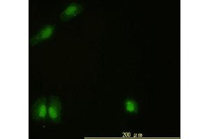 Immunofluorescence of monoclonal antibody to CAMK4 on HeLa cell.
