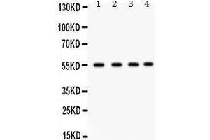Western Blotting (WB) image for anti-Gap Junction Protein, alpha 3, 46kDa (GJA3) (AA 89-118), (N-Term) antibody (ABIN3042423) (GJA3 抗体  (N-Term))