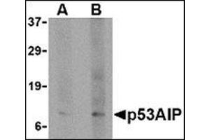 Western blot analysis of p53AIP1 in HL60 cell lysate with this product at (A) 4 and (B) 8 μg/ml.