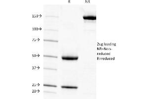 SDS-PAGE Analysis Purified Adipophilin Mouse Monoclonal Antibody (ADFP/1494). (ADRP 抗体  (AA 249-376))