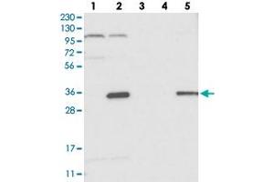 Western blot analysis of Lane 1: RT-4, Lane 2: U-251 MG, Lane 3: Human Plasma, Lane 4: Liver, Lane 5: Tonsil with C14orf94 polyclonal antibody . (C14orf94 抗体)