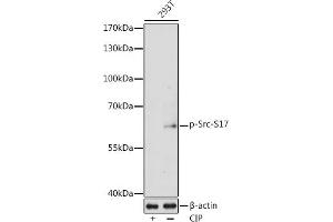 Western blot analysis of extracts of 293T cells, using Phospho-Src-S17 antibody  at 1:1000 dilution. (Src 抗体  (pSer17))