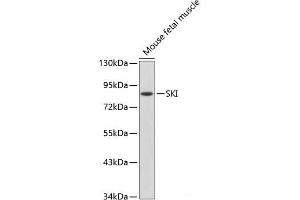 Western blot analysis of extracts of Mouse fetal muscle using SKI Polyclonal Antibody. (SKI 抗体)