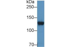 Western Blot; Sample: Rat Cerebrum lysate; Primary Ab: 2µg/ml Rabbit Anti-Human DPP6 Antibody Second Ab: 0. (DPP6 抗体  (AA 667-865))