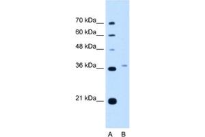 Western Blotting (WB) image for anti-Peroxisomal Biogenesis Factor 3 (PEX3) antibody (ABIN2462935) (PEX3 抗体)