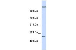 WB Suggested Anti-GABARAP Antibody Titration:  0. (GABARAP 抗体  (N-Term))
