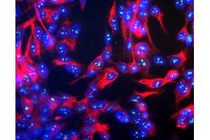Human SH-SY5Y cells stained with mouse-anti-fibrillarin, showing prominent specular nucleolar staining. (Fibrillarin 抗体)