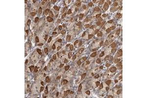 Immunohistochemical staining of human stomach with PARP6 polyclonal antibody  shows strong cytoplasmic positivity in Parietal cells at 1:50-1:200 dilution. (PARP6 抗体)