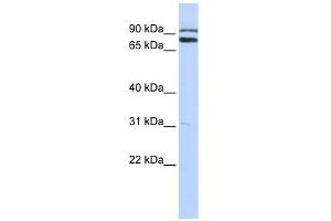 TRIM67 antibody used at 1 ug/ml to detect target protein. (TRIM67 抗体  (C-Term))