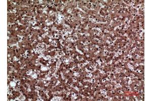 Immunohistochemistry (IHC) image for anti-F11 Receptor (F11R) (Internal Region) antibody (ABIN3187971)