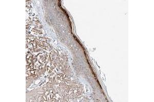 Immunohistochemical staining of human skin with TSR2 polyclonal antibody  shows strong positivity in superficial layers. (TSR2 抗体)