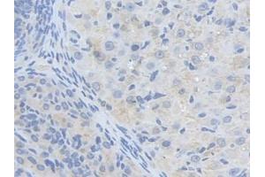 DAB staining on IHC-P; Samples: Mouse Ovary Tissue (ALDH9A1 抗体  (AA 322-494))