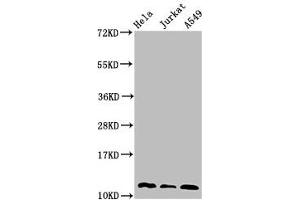 Western Blot Positive WB detected in: Hela whole cell lysate, Jurkat whole cell lysate, A549 whole cell lysate All lanes: TXN antibody at 3 μg/mL Secondary Goat polyclonal to rabbit IgG at 1/50000 dilution Predicted band size: 12, 10 kDa Observed band size: 12 kDa (TXN 抗体  (AA 2-105))