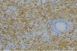 ABIN6279132 at 1/100 staining Human uterus tissue by IHC-P. (Apolipoprotein L 5 抗体  (C-Term))