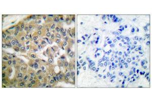 Immunohistochemistry (IHC) image for anti-Fragile Histidine Triad (FHIT) (Internal Region) antibody (ABIN1848544) (FHIT 抗体  (Internal Region))