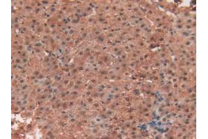 IHC-P analysis of Human Liver Tissue, with DAB staining. (TEK 抗体  (AA 1-116))