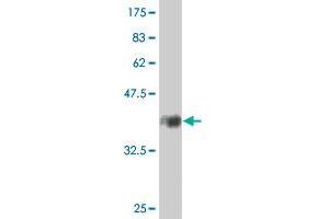 Western Blot detection against Immunogen (38. (PDLIM1 抗体  (AA 123-232))