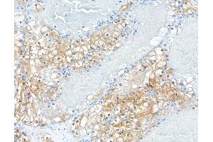 Immunohistochemistry (IHC) image for anti-Macrophage Migration Inhibitory Factor (Glycosylation-Inhibiting Factor) (MIF) (AA 2-115) antibody (ABIN7449528)