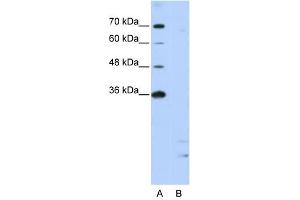 PPIE antibody used at 2. (PPIE 抗体)