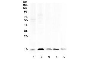 Western blot testing of 1) human placenta, 2) human HeLa, 3) rat spleen, 4) rat RH35 and 5) mouse spleen lysate with Psoriasin antibody at 0. (S100A7 抗体)