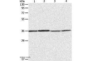 Western blot analysis of Hela, 293T, A431 and Jurkat cell, using RPLP0 Polyclonal Antibody at dilution of 1:600 (RPLP0 抗体)