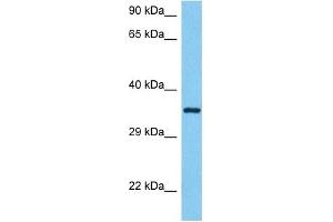 Host:  Mouse  Target Name:  ANXA5  Sample Tissue:  Mouse Brain  Antibody Dilution:  1ug/ml (Annexin V 抗体  (N-Term))