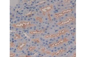 Immunohistochemistry (IHC) image for anti-Solute Carrier Family 4, Anion Exchanger, Member 1 (erythrocyte Membrane Protein Band 3, Diego Blood Group) (SLC4A1) (AA 558-675) antibody (ABIN5013133)
