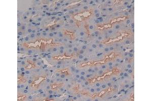 Used in DAB staining on fromalin fixed paraffin- embedded Kidney tissue (Band 3/AE1 抗体  (AA 558-675))
