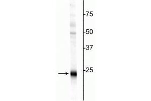 Western blot of rat hippocampal homogenate showing specific immunolabeling of the ~24 kDa UCHL1 protein. (UCHL1 抗体)