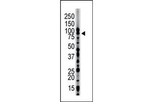 Image no. 1 for anti-Hepatocyte Growth Factor-Regulated tyrosine Kinase Substrate (HGS) (N-Term) antibody (ABIN357582) (HGS 抗体  (N-Term))