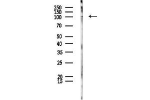 anti-Dynamin 2 (DNM2) (C-Term) antibody