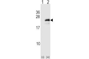 Western Blotting (WB) image for anti-Neurogenin 3 (NEUROG3) antibody (ABIN3001396) (Neurogenin 3 抗体)