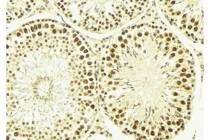 ABIN6269184 at 1/100 staining Mouse testis tissue by IHC-P. (ELK1 抗体  (C-Term))