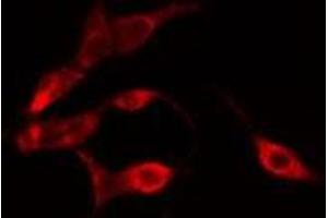 ABIN6275169 staining HeLa cells by IF/ICC.