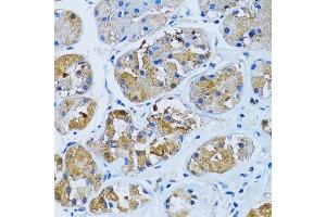 Immunohistochemistry (Paraffin-embedded Sections) (IHC (p)) image for anti-Inositol(myo)-1(or 4)-Monophosphatase 1 (IMPA1) (AA 1-277) antibody (ABIN6142429)