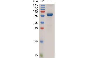 Human PRLR Protein, hFc Tag on SDS-PAGE under reducing condition.