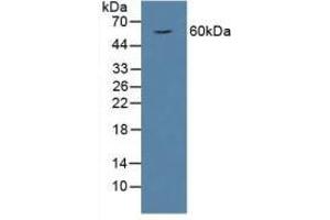 Detection of HPSE in Rat Serum using Polyclonal Antibody to Heparanase (HPSE) (HPSE 抗体  (AA 40-188))