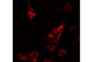 ABIN6274994 staining HuvEc by IF/ICC. (CBLN1 抗体  (C-Term))