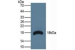 Detection of RNASE3 in Mouse Lymphonodus Tissue using Polyclonal Antibody to Ribonuclease A3 (RNASE3) (RNASE3 抗体  (AA 34-150))