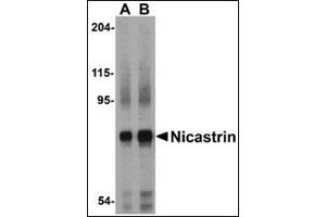 Western blot analysis of Nicastrin in human brain tissue lysate with this product at (A) 0. (Nicastrin 抗体  (Center))