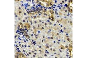 Immunohistochemical analysis of B9D1 staining in rat kidney formalin fixed paraffin embedded tissue section. (B9D1 抗体)