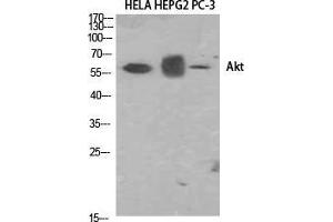 Western Blot (WB) analysis of HELA, HepG2, PC-3 using Akt1 Polyclonal Antibody. (AKT1 抗体  (N-Term))