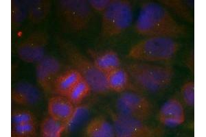 Immunofluorescence staining of methanol-fixed Hela cells using GluR1(Ab-863) Antibody. (Glutamate Receptor 1 抗体)