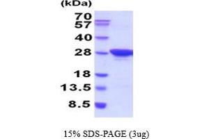 Mesoderm Development Candidate 2 (MESDC2) (AA 30-224) protein (His tag)