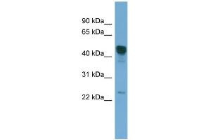 WB Suggested Anti-DYX1C1 Antibody Titration: 0. (DYX1C1 抗体  (Middle Region))