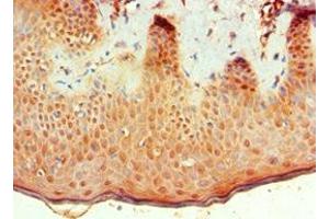 Immunohistochemistry of paraffin-embedded human skin tissue using ABIN7145683 at dilution of 1:100 (BMP15 抗体  (AA 143-392))