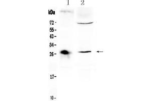 Western blot analysis of CD151 using anti- CD151 antibody .